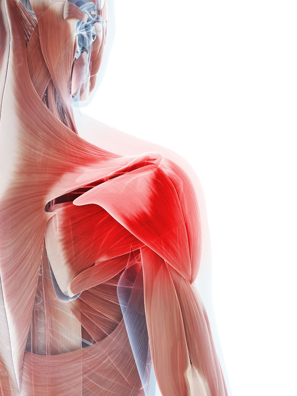 Inflammation